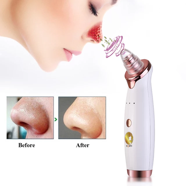 BLACKHEAD REMOVER .PORE VACUUM.